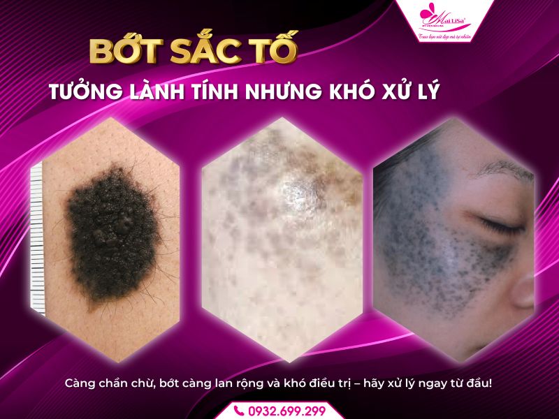 bot-sac-to-tuong-lanh-tinh-nhung-kho-xu-ly