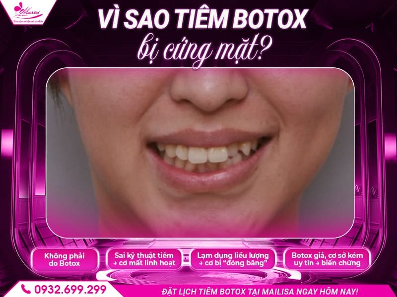 botox-co-lam-cung-mat-khong
