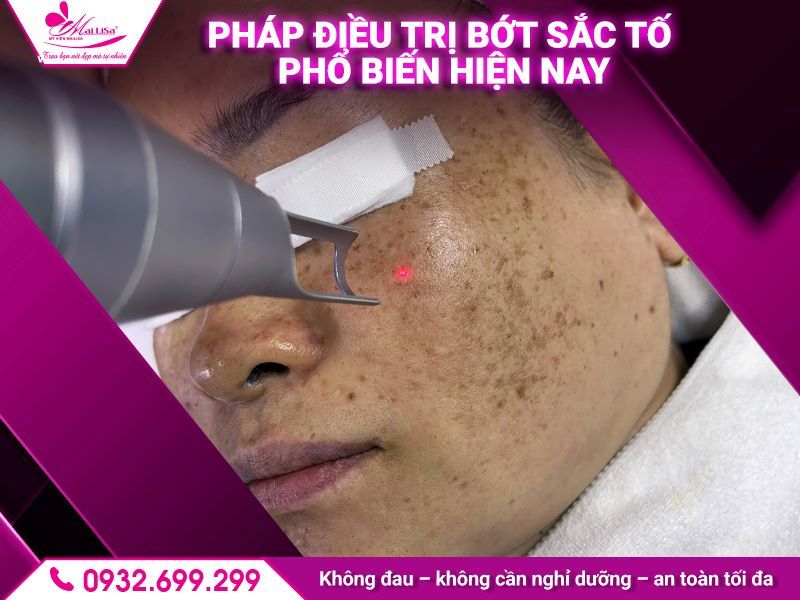 cac-phuong-phap-dieu-tri-bot-sac-to-pho-bien-hien-nay