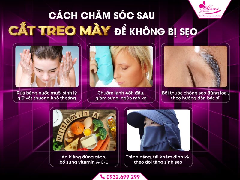 cach-cham-soc-sau-cat-treo-may-de-khong-bi-seo