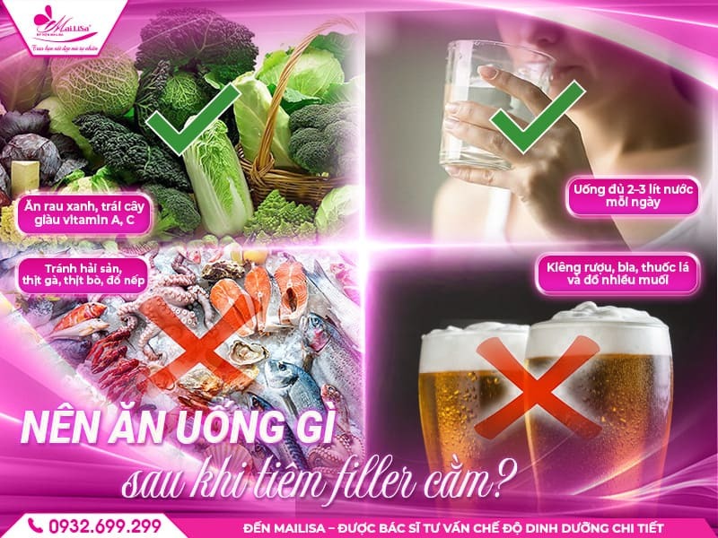 cach-cham-soc-sau-tiem-filler-cam