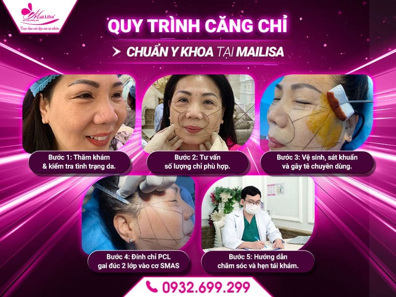 cang-chi-bao-lau-thi-thay-ket-qua