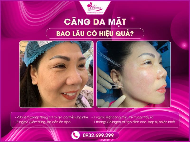 cang-da-mat-bao-lau-co-hieu-qua