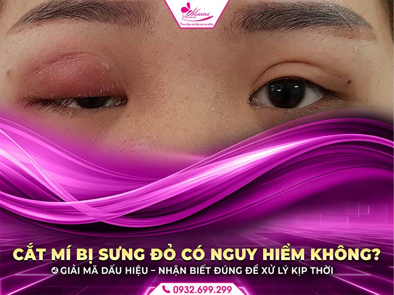cat-mi-bi-sung-do-co-nguy-hiem-khong