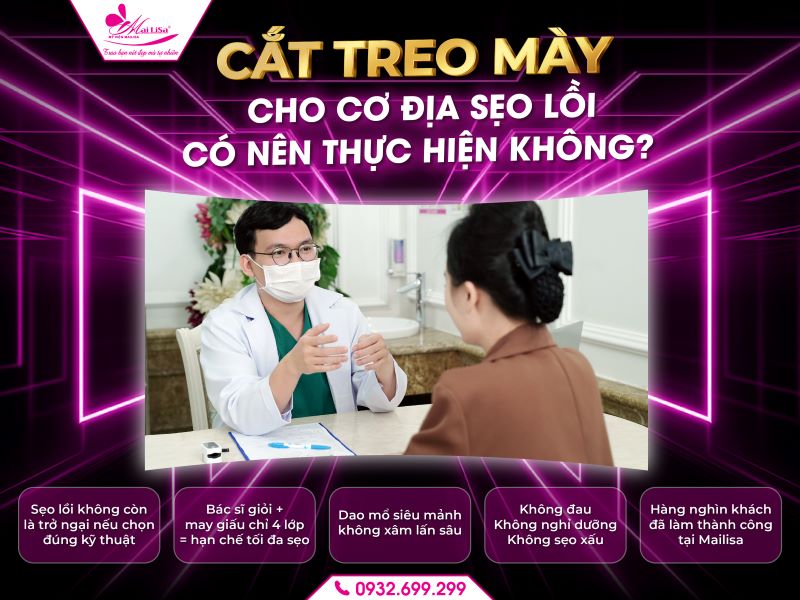 cat-treo-may-cho-co-dia-seo-loi