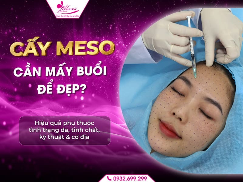 cay-meso-can-may-buoi-de-dep