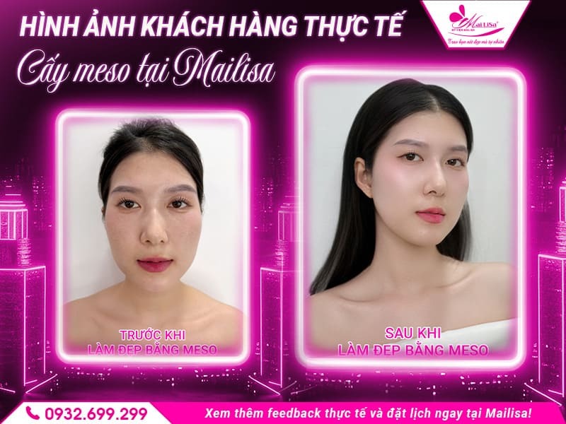cay-meso-co-hieu-qua-khong