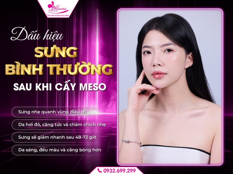 cay-meso-co-sung-khong