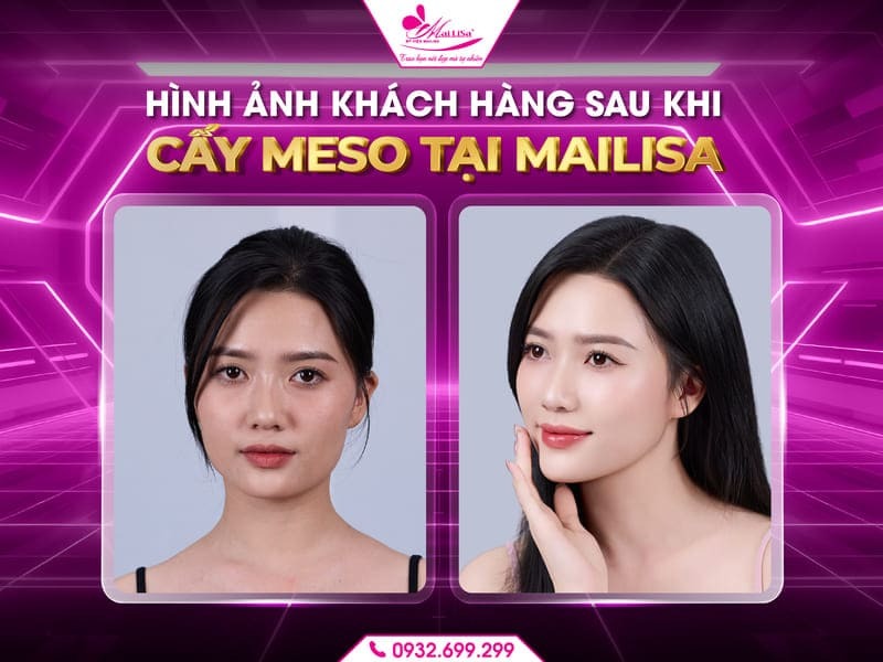 cay-meso-co-sung-khong