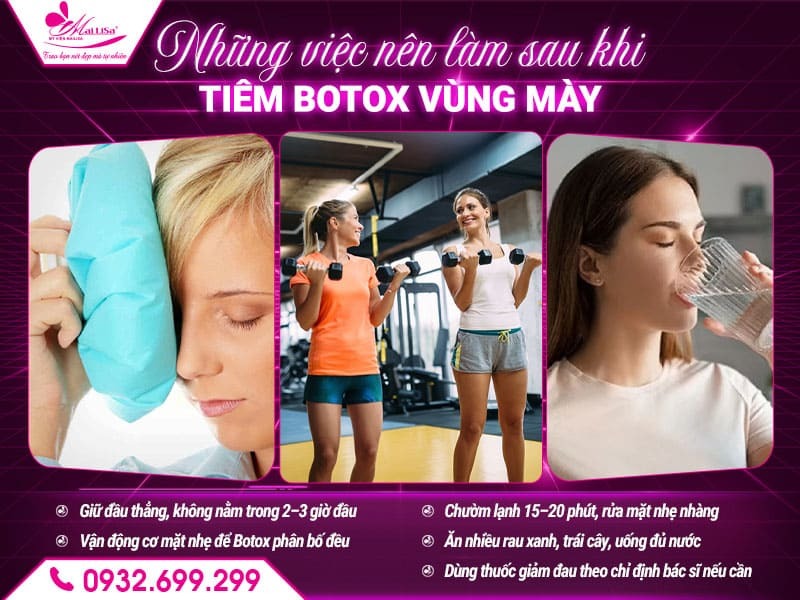 cham-soc-sau-khi-tiem-botox-vung-may