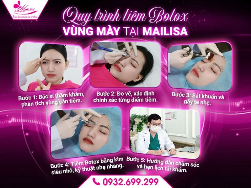 cham-soc-sau-khi-tiem-botox-vung-may