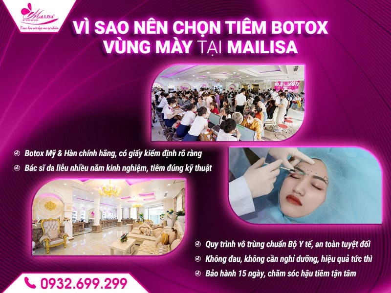 cham-soc-sau-khi-tiem-botox-vung-may