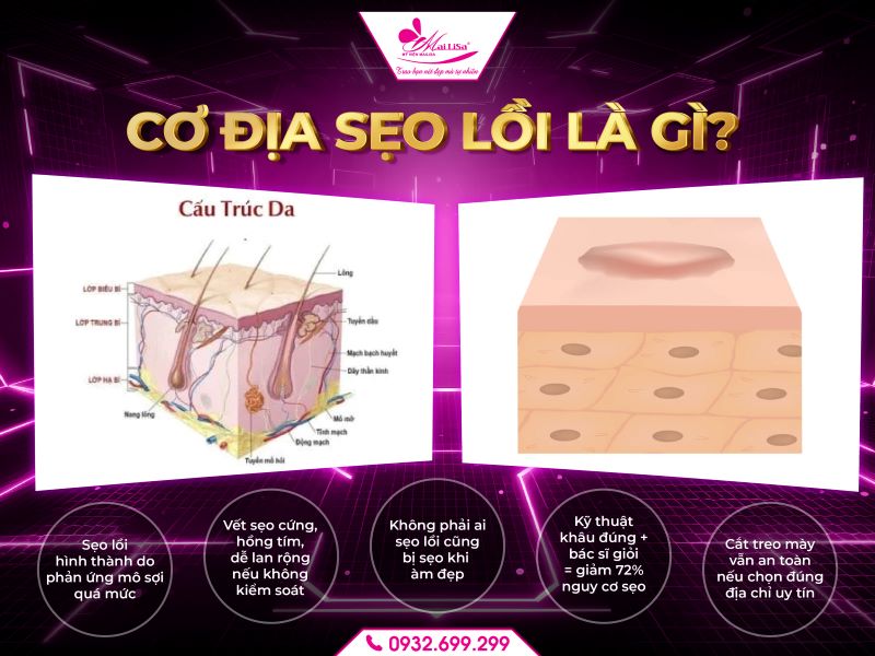 co-dia-seo-loi-la-gi