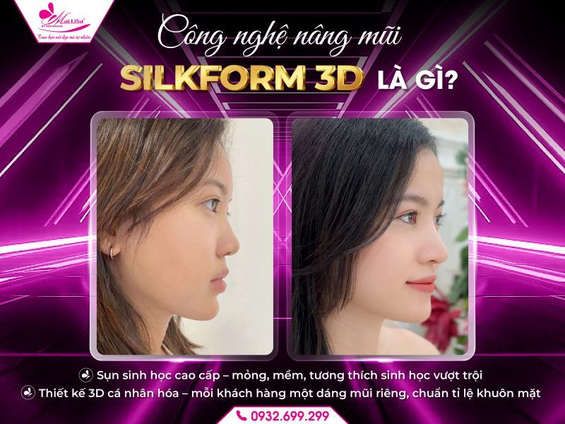 cong-nghe-nang-mui-silkform-3d-la-gi
