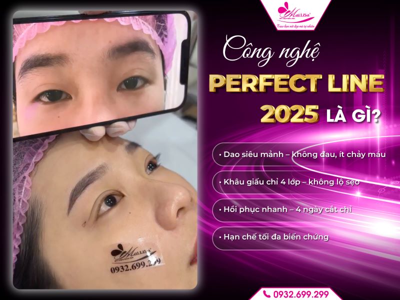 cong-nghe-perfect-line-2025-la-gi