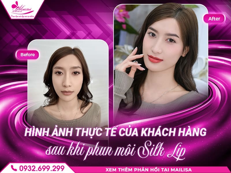 cong-nghe-phun-moi-moi-2025