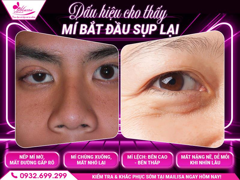 dau-hieu-cho-thay-mi-bat-dau-sup-lai
