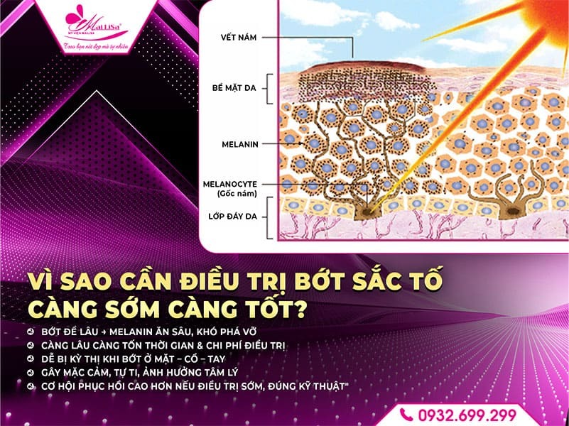 dieu-tri-bot-sac-to