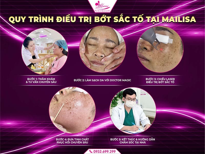 dieu-tri-bot-sac-to