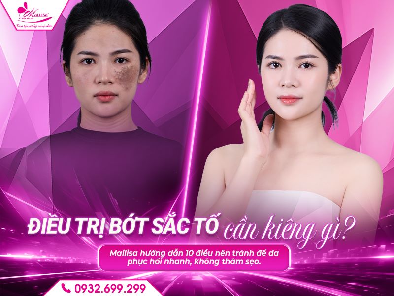 dieu-tri-bot-sac-to-can-kieng-gi