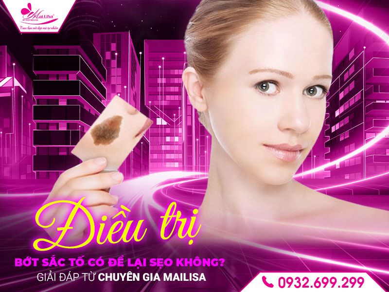 dieu-tri-bot-sac-to-co-de-lai-seo-khong