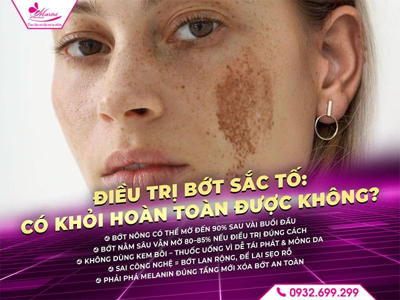 dieu-tri-bot-sac-to