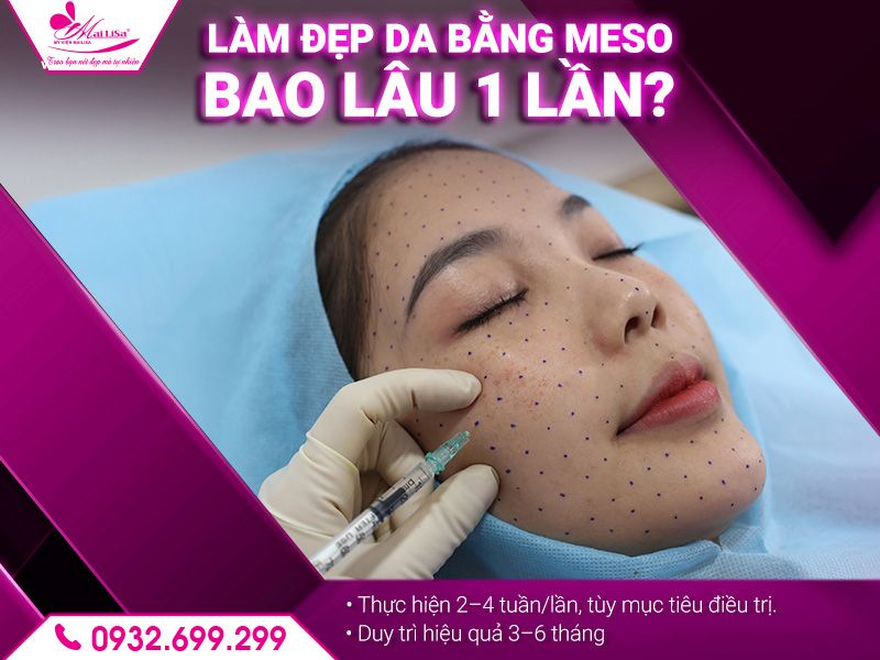 lam-dep-da-bang-meso-bao-lau-1-lan