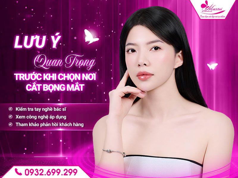 luu-y-quan-trong