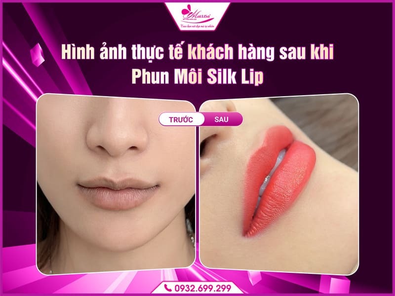 luu-y-sau-khi-phun-moi-cong-nghe-moi