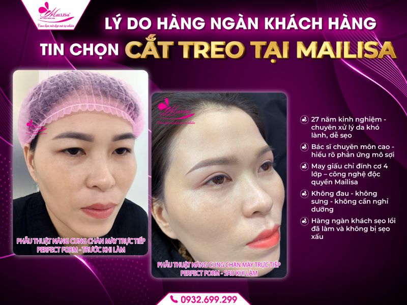 ly-do-hang-ngan-khach-hang-tin-chon-cat-treo-tai-mailisa
