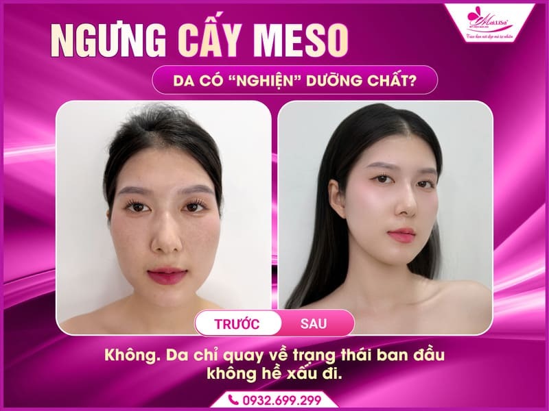 ngung-cay-meso-da-co-xau-di-khong