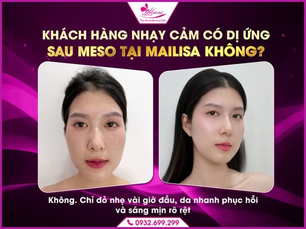 nguy-co-di-ung-sau-khi-cay-meso