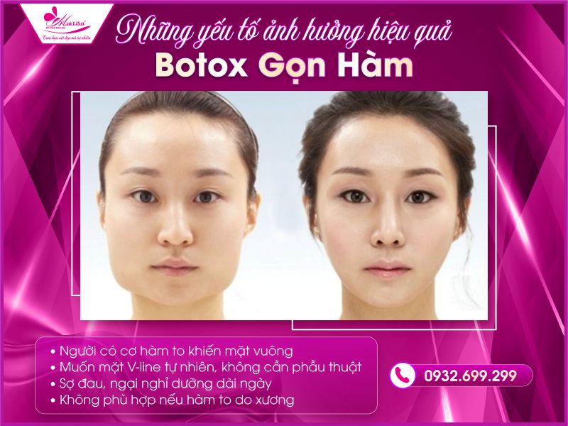 nhung-yeu-to-anh-huong-hieu-qua-botox-gon-ham