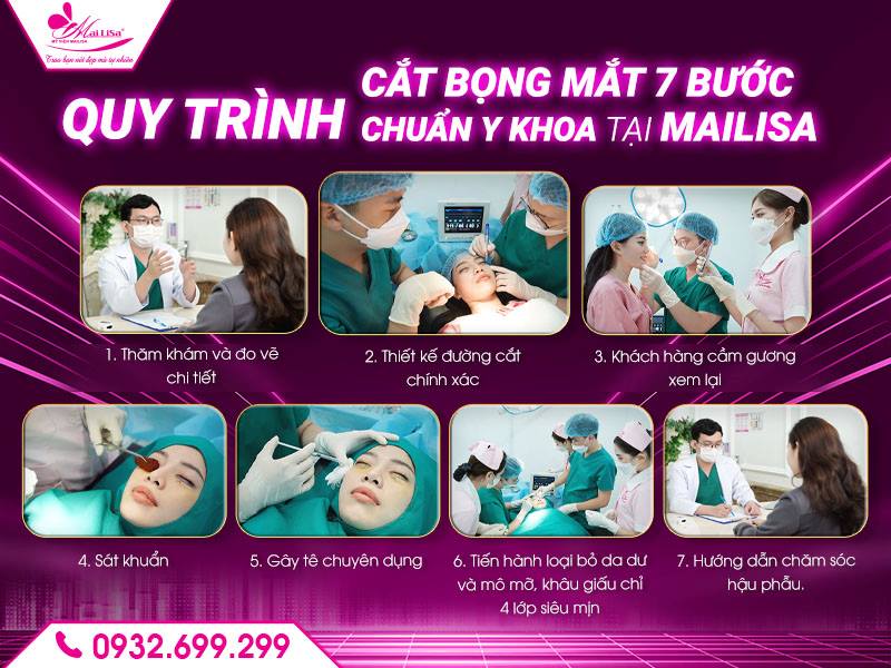 quy-trinh-cat-bong-mat