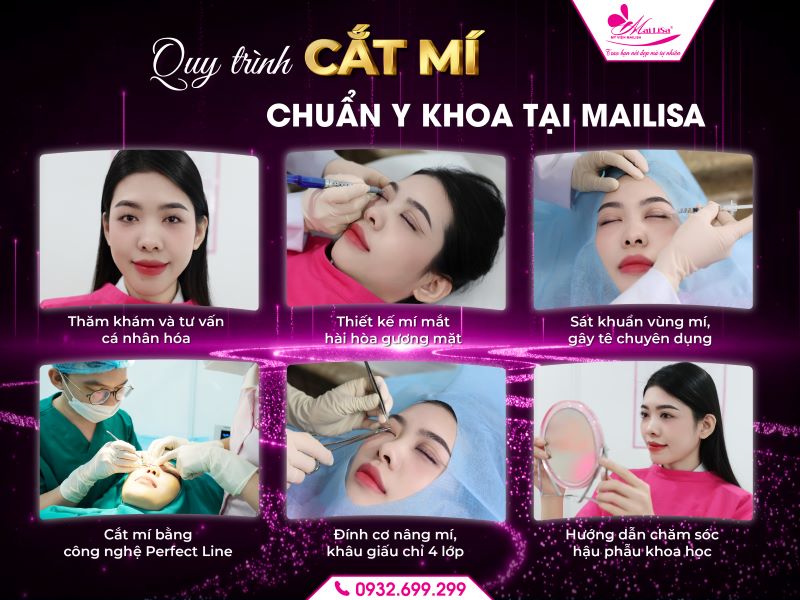 quy-trinh-cat-mi-chuan-y-khoa-tai-mailisa