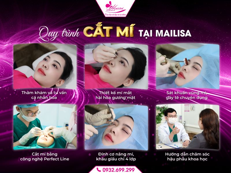 quy-trinh-cat-mi-tai-mailisa