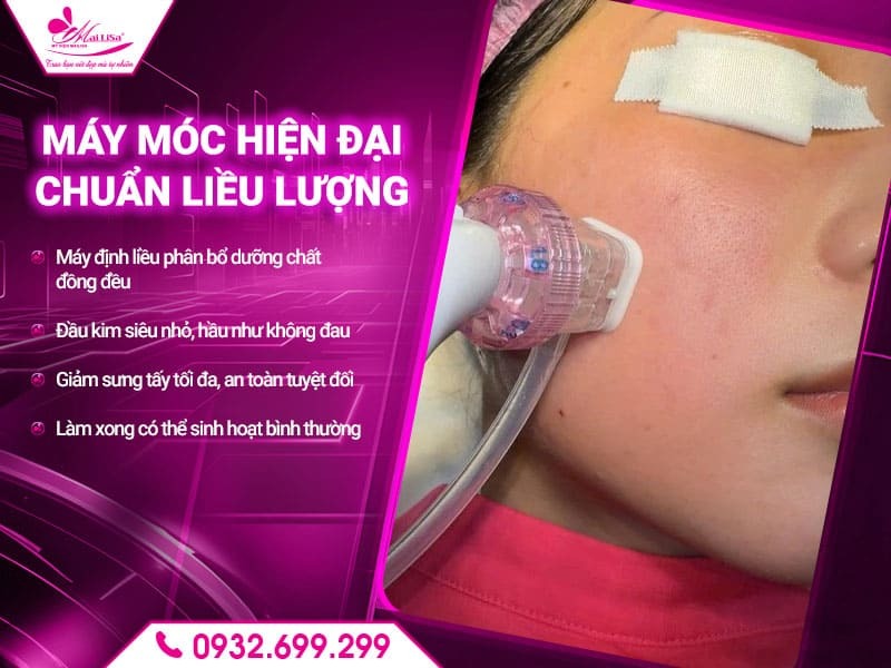quy-trinh-cay-meso-tai-mailisa