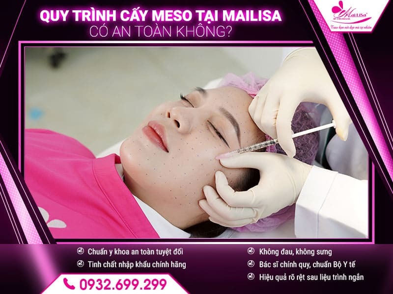 quy-trinh-cay-meso-tai-mailisa