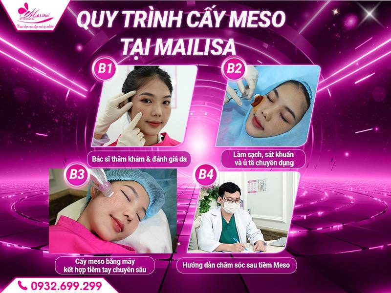 quy-trinh-cay-meso