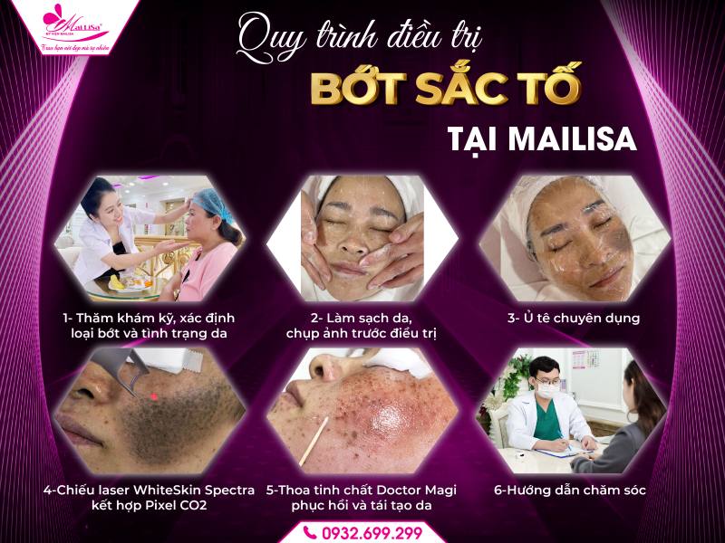 quy-trinh-dieu-tri-bot-sac-to-tai-mailisa