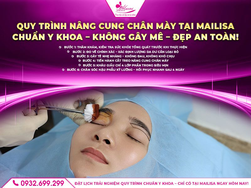 quy-trinh-nang-cung-chan-may-tai-mailisa