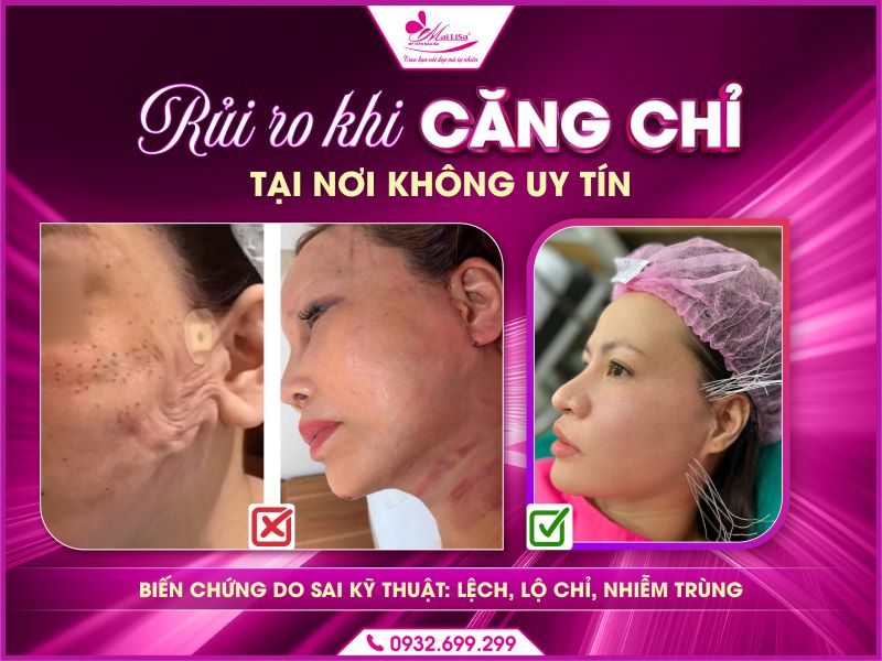 rui-ro-khi-cang-chi-tai-noi-khong-uy-tin