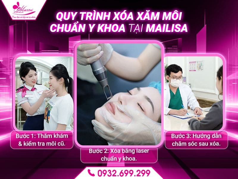 sau-khi-xoa-phun-moi-co-can-phun-lai-khong