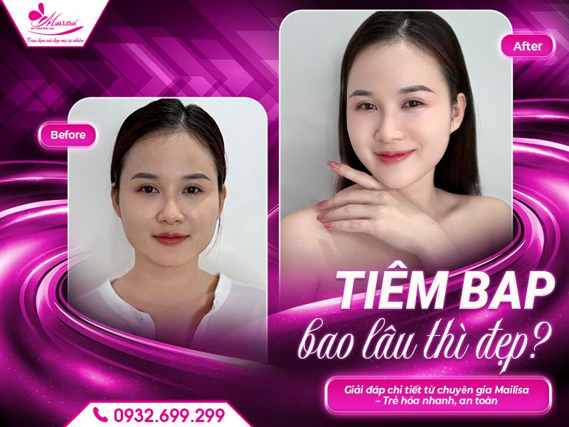 tiem-bap-bao-lau-thi-dep