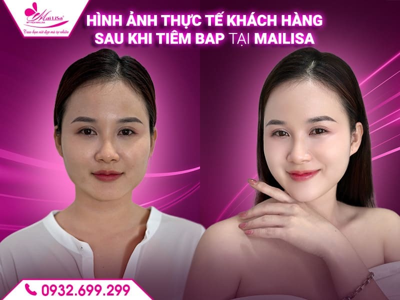 tiem-bap-co-gay-di-ung-khong