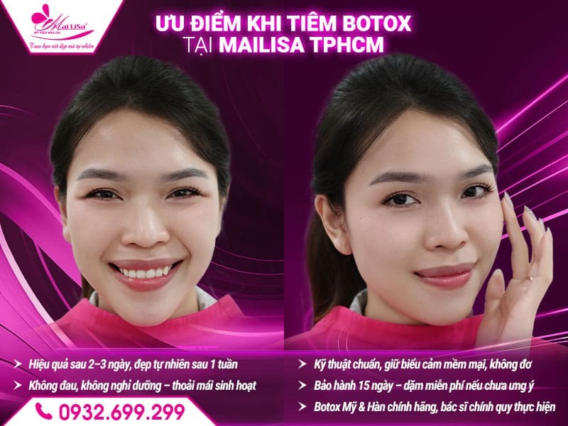 tiem-botox-mailisa-tphcm