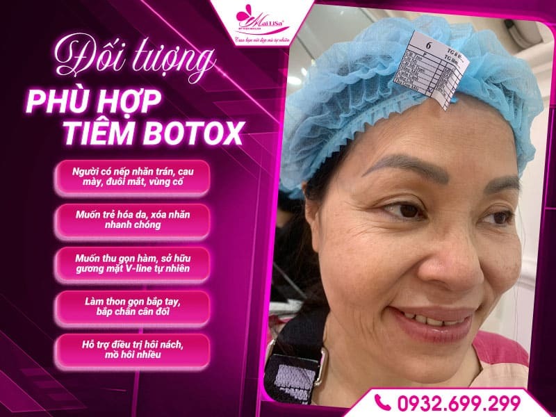 tiem-botox-mailisa-tphcm