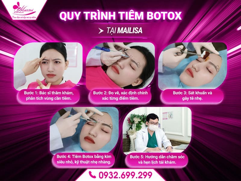 tiem-botox-mailisa-tphcm