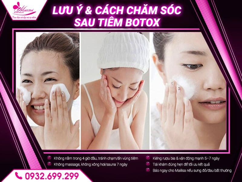 tiem-botox-mailisa-tphcm