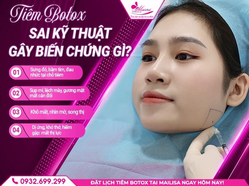 tiem-botox-sai-ky-thuat-gay-bien-chung-gi